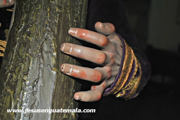 mynor esquivel escazu 1