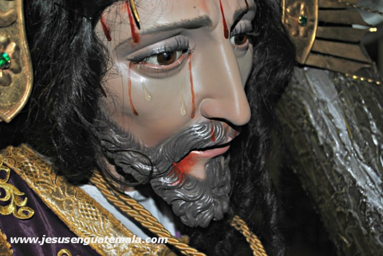 mynor esquivel escazu 10