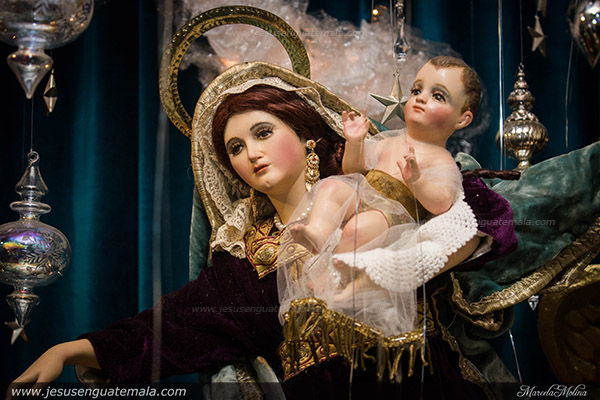 nacimiento alex leiva 1j